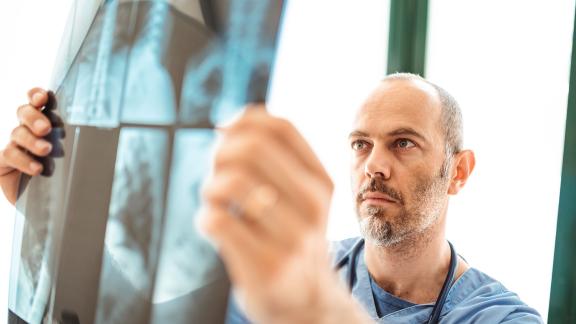 A doctor checking an x-ray.