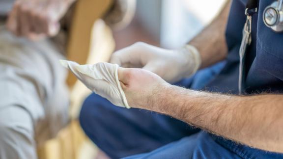 A close-up of a doctor putting on gloves.